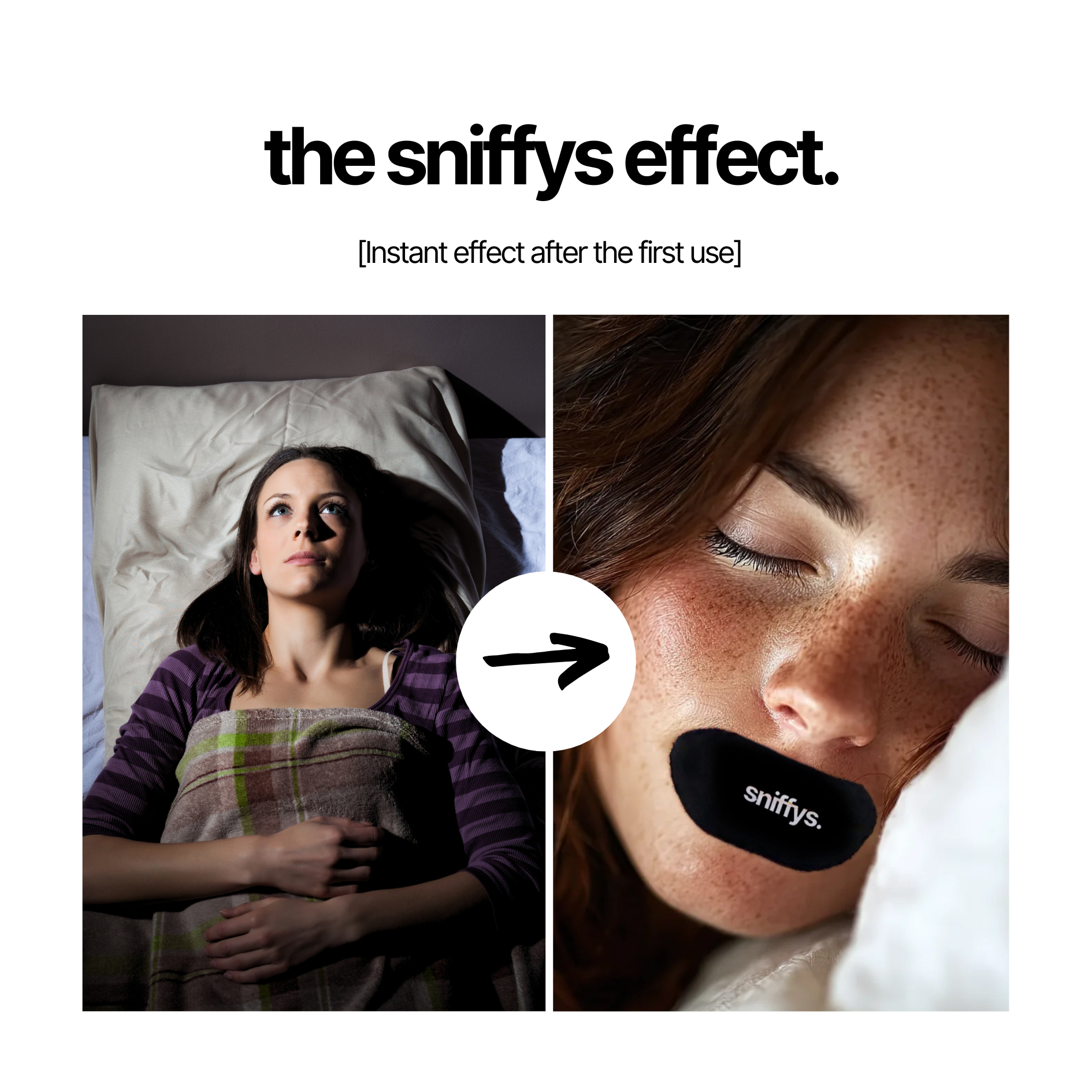 sniffys. Mund Tape (30 Stück) – Bild 2