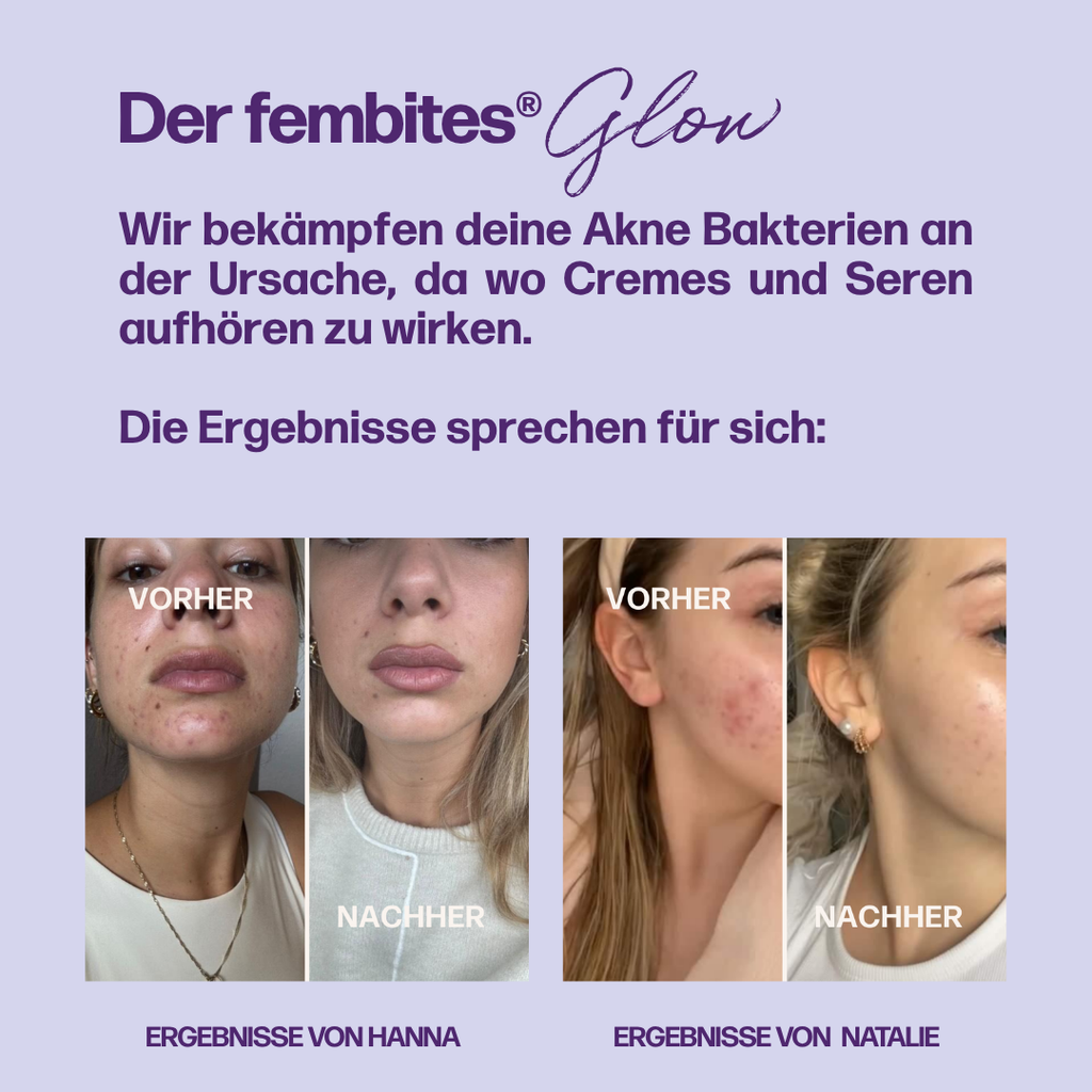 femcaps® SKIN GLOW – Bild 4