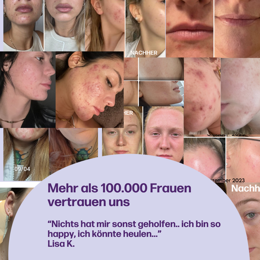 femgums® ZYKLUS BALANCE – Bild 6